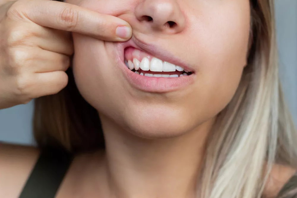 Gum Treatment