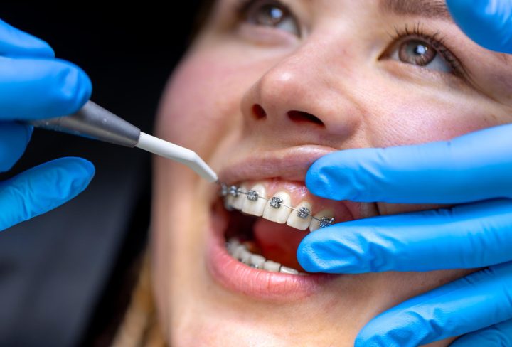 EN-B-DEN-CN1-V827_20260421_160042_v1